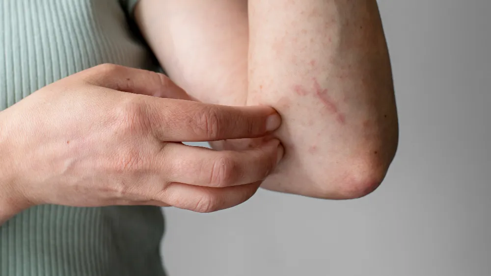 Controle de Bicho Geográfico - Rio de janeiro // Dedetizadora RJ